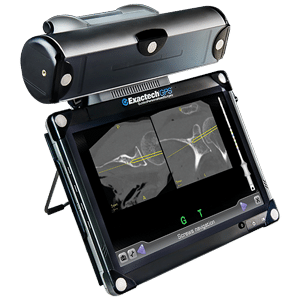 ExactechGPS Guided Personalized Surgery. ExactechGPS® is a compact, surgeon controlled, computer-assisted surgical technology that delivers reproducibility in total joint arthroplasty.
