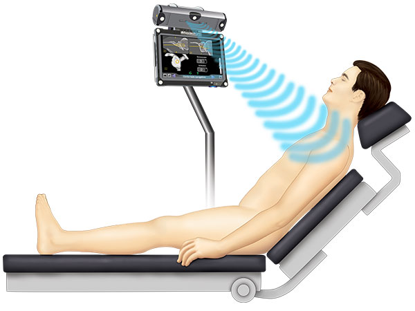 Illustration of a patient getting shoulder replacement surgery with ExactechGPS computer assisted technology