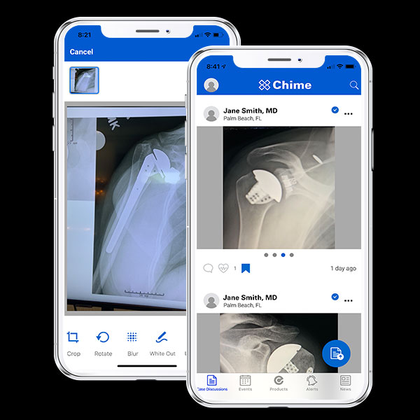 Chime is a mobile application for Surgeon Clinical Exchange