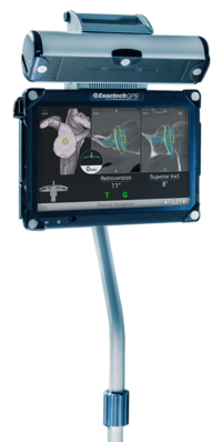 ExactechGPS Compact system within sterile field