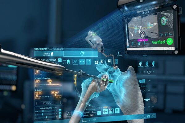 Exactech Equinoxe Shoulder with GPS Technology for Shoulder Replacement