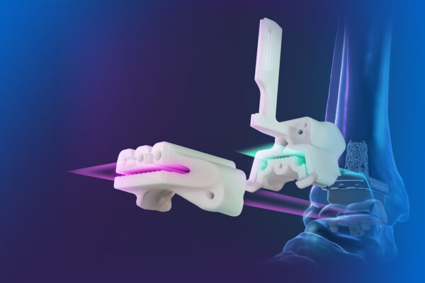 Exactech Vantage Ankle PSI