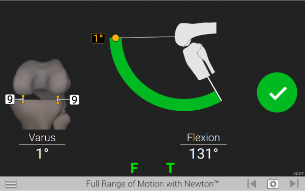 Exactech Knee Newton GPS Technology for TKA