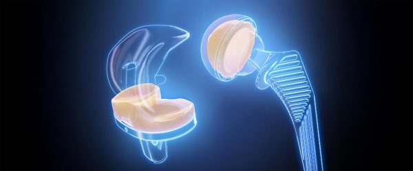 Exactech Poly Alteon XLE highly crosslinked vitamin E-enhanced acetabular liners and Activit-E vitamin E polyethylene knee inserts