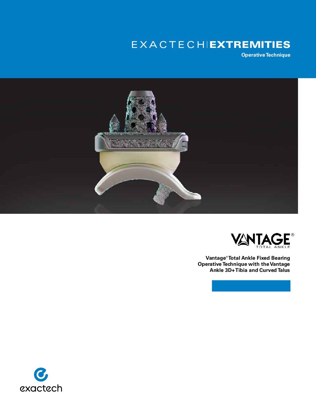 Vantage Ankle 3D+ Curved Talus Operative Technique