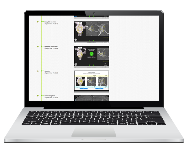 Shoulder Planning App Post-operative Surgical Reports Screen