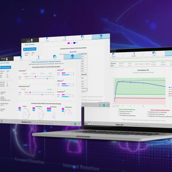 Exactech Showcases Groundbreaking Research in AI and Personalized Surgical Technologies - Predict+ screens