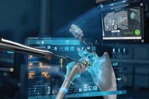 Exactech Shoulder Planning App and GPS Shoulder. First and only shoulder navigation technology that connects the preoperative plan with real-time intraoperative instrument guidance and verifies implant placement.