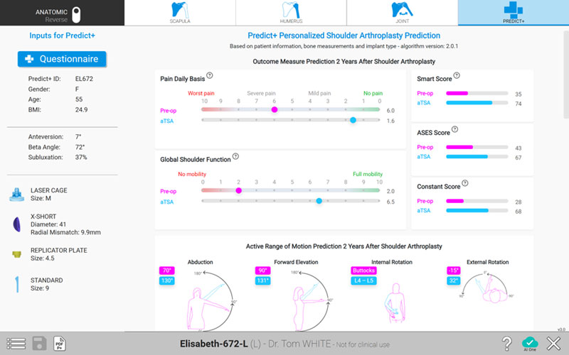 Predict+, the First Machine Learning Tool for Predictive Outcomes in Shoulder Replacement Surgery
