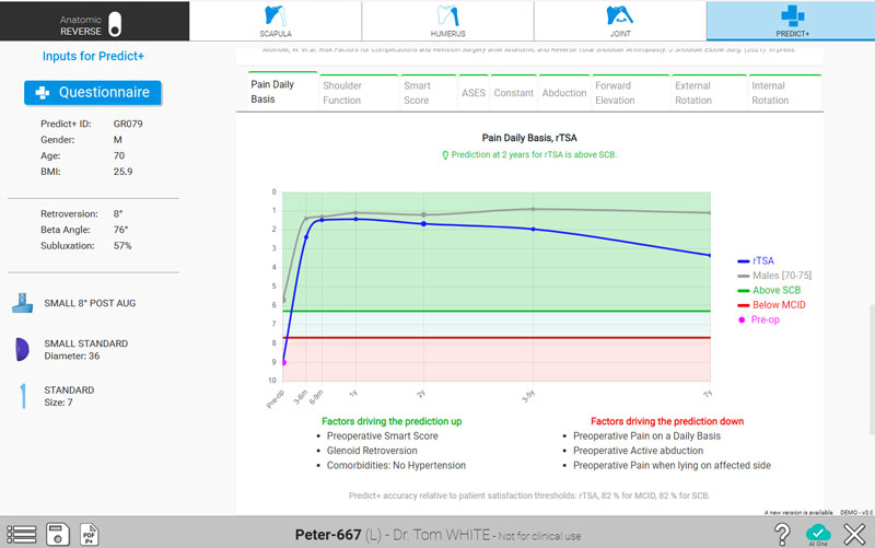 Predict+, the First Machine Learning Tool for Predictive Outcomes in Shoulder Replacement Surgery
