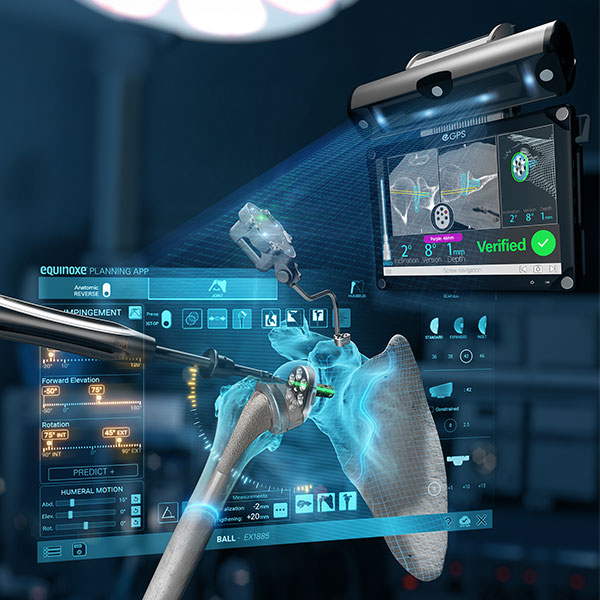 Exactech GPS and Equinoxe Planning app for shoulder