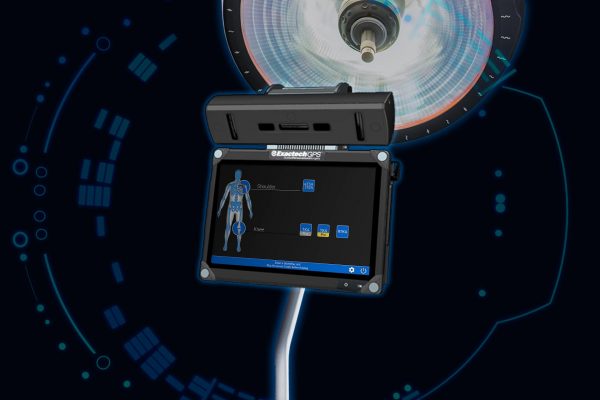 The next generation of ExactechGPS guided personalized surgery for total knee and shoulder replacement.