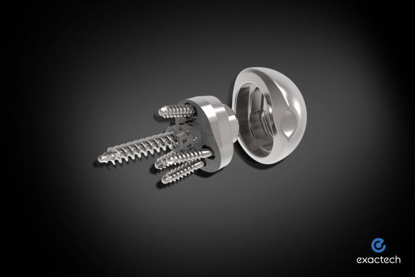 Exactech Shoulder Central Screw Baseplate